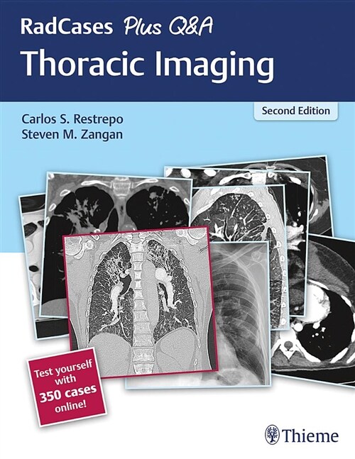 Radcases Plus Q&A Thoracic Imaging (Paperback, 2)