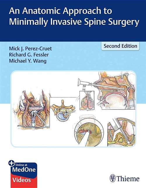 An Anatomic Approach to Minimally Invasive Spine Surgery (Hardcover, 2)