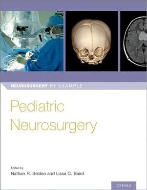 Pediatric Neurosurgery (Paperback)