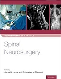 Spinal Neurosurgery (Paperback)