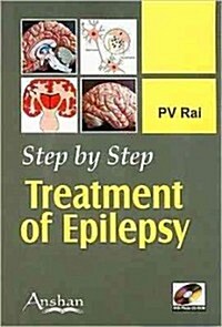 Step by Step: Treatment of Epilepsy [With Mini CDROM] (Paperback)