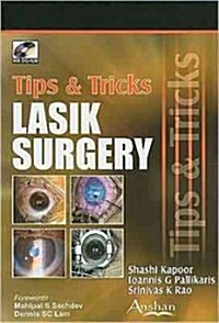 Lasik Surgery : Tips and Tricks (Paperback)