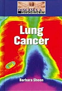 Lung Cancer (Library Binding)