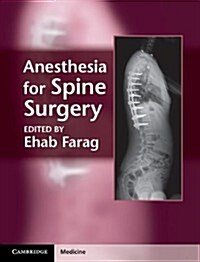 Anesthesia for Spine Surgery (Hardcover)