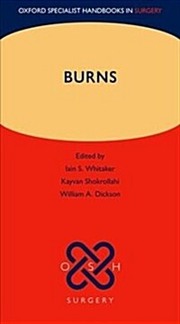 Burns (Part-work (fascA­culo))