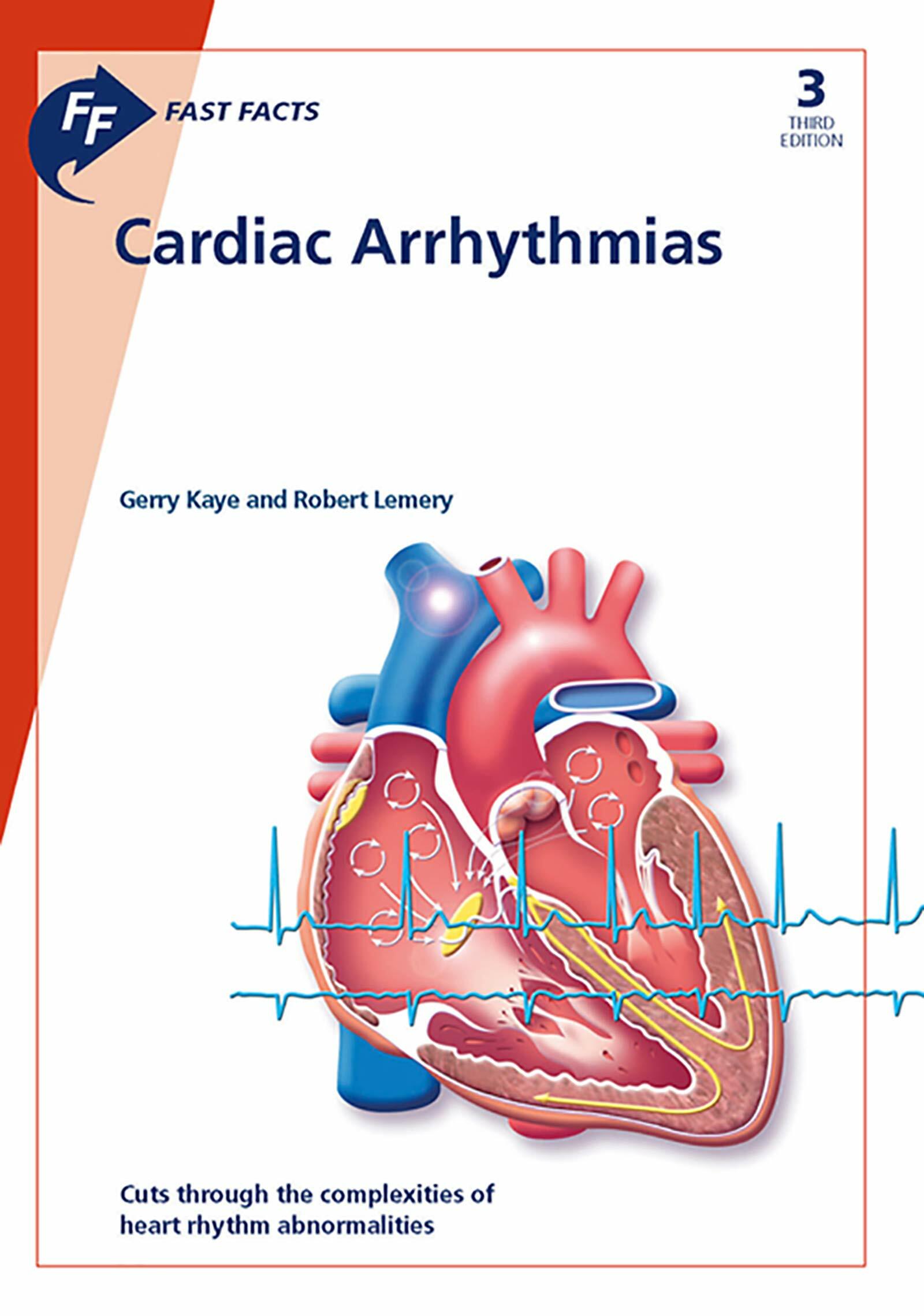 Fast Facts: Cardiac Arrhythmias (Paperback, 3rd edition)