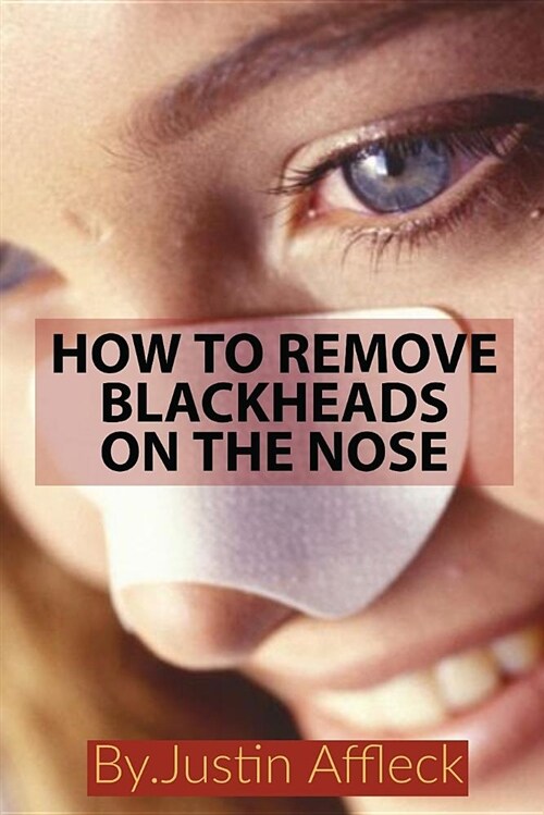 How to Remove Blackheads on the Nose: 10 Best Ways to Get Rid of Blackheads on the Nose at Home (Paperback)