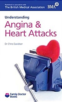 Understanding Angina & Heart Attacks (Paperback)