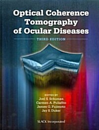 Optical Coherence Tomography of Ocular Diseases (Hardcover, 3)