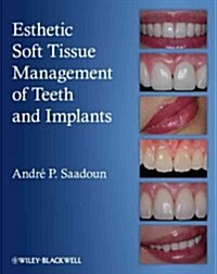 Esthetic Soft Tissue Management of Teeth and Implants (Hardcover)