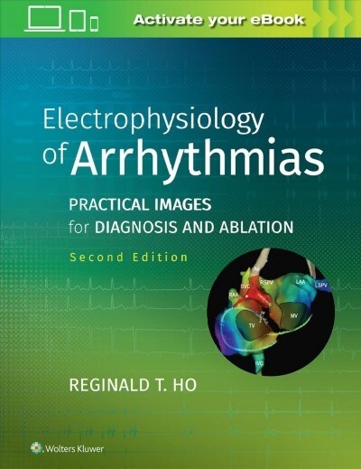 Electrophysiology of Arrhythmias: Practical Images for Diagnosis and Ablation (Hardcover, 2)