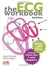 ECG Workbook (Paperback)