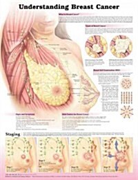 Understanding Breast Cancer 3e Laminated (Hardcover, 3, Revised)