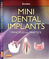 Mini Dental Implants: Principles and Practice (Hardcover)