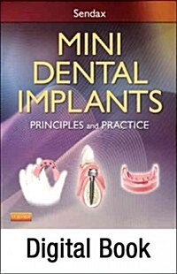 Mini Dental Implants - Elsevier eBook on Vitalsource (Retail Access Card): Principles and Practice (Hardcover)