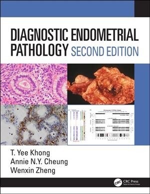 Diagnostic Endometrial Pathology 2E (Hardcover, 2 ed)