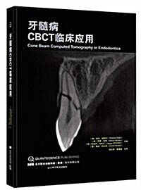 牙髓病CBCT臨牀應用 (精裝, 第1版)