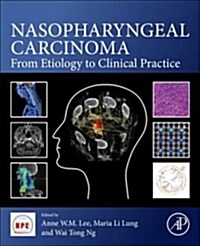 Nasopharyngeal Carcinoma: From Etiology to Clinical Practice (Paperback)
