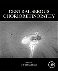 Central Serous Chorioretinopathy (Paperback)