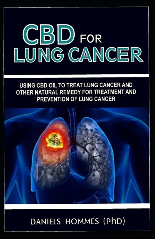 CBD for Lung Cancer: Using CBD Oil to Treat Lung Cancer and Other Natural Remedy for Treatment and Prevention of Lung Cancer (Paperback)