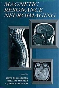 Magnetic Resonance Neuroimaging (Hardcover)