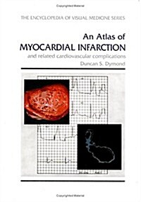 An Atlas of Myocardial Infarction (Hardcover)