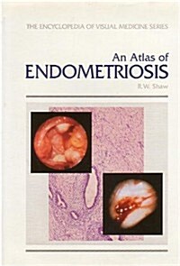 An Atlas of Endometriosis (Hardcover)