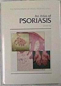 An Atlas of Psoriasis (Hardcover)
