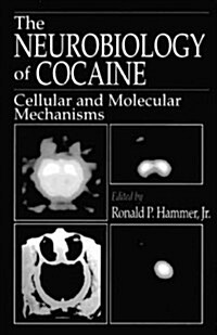 The Neurobiology of Cocaine: Cellular and Molecular Mechanisms (Hardcover)