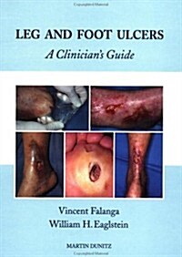 Leg and Foot Ulcers (Hardcover)