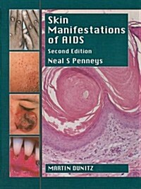 Skin Manifestations Of Aids, Second Edition (Hardcover, 2 New edition)