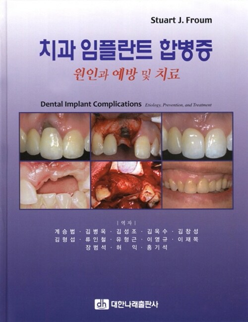 [중고] 치과 임플란트 합병증 : 원인과 예방 및 치료