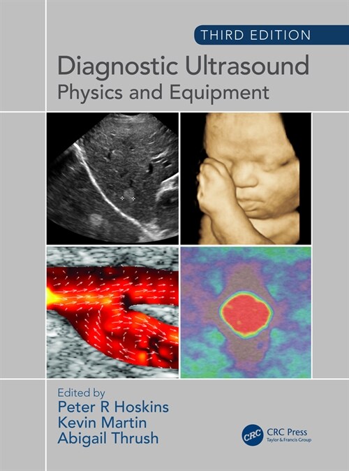 Diagnostic Ultrasound, Third Edition : Physics and Equipment (Hardcover, 3 ed)