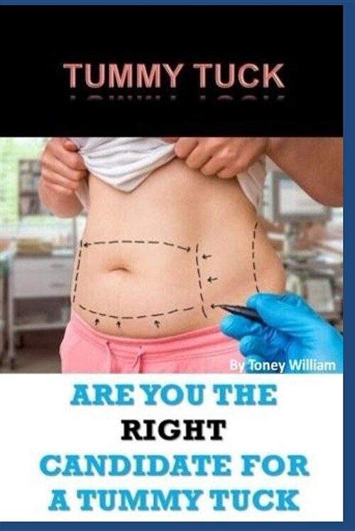 Tummy Tuck: Are You the Right Candidate for a Tummy Tuck (Paperback)