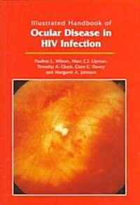 Illustrated Handbook of Ocular Disease in HIV Infection (Paperback, Illustrated)