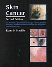 Skin Cancer (Hardcover, 2nd)