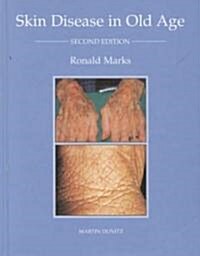Skin Disease of Old Age (Hardcover, 2nd, Subsequent)