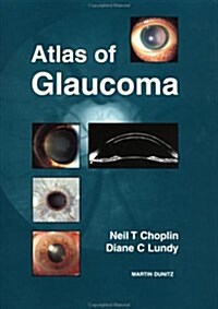 Atlas of Glaucoma (Hardcover)