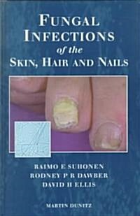Fungal Infections of the Skin and Nails (Hardcover)