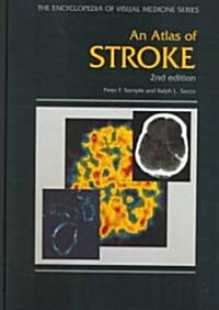 An Atlas of Stroke (Hardcover, 2 Rev ed)