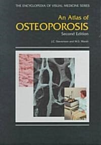 An Atlas of Osteoporosis (Hardcover, 2nd, Subsequent)