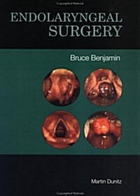 Endolaryngeal Surgery (Hardcover)