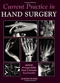 Current Practice in Hand Surgery (Hardcover)