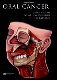 Oral Cancer (Hardcover)