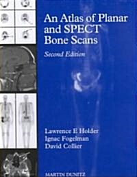 An Atlas of Planar and Spect Bone Scans (Hardcover, 2nd)