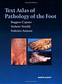 Text Atlas of Pathology of the Foot (Hardcover)