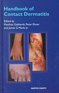 Handbook of Contact Dermatitis (Hardcover)