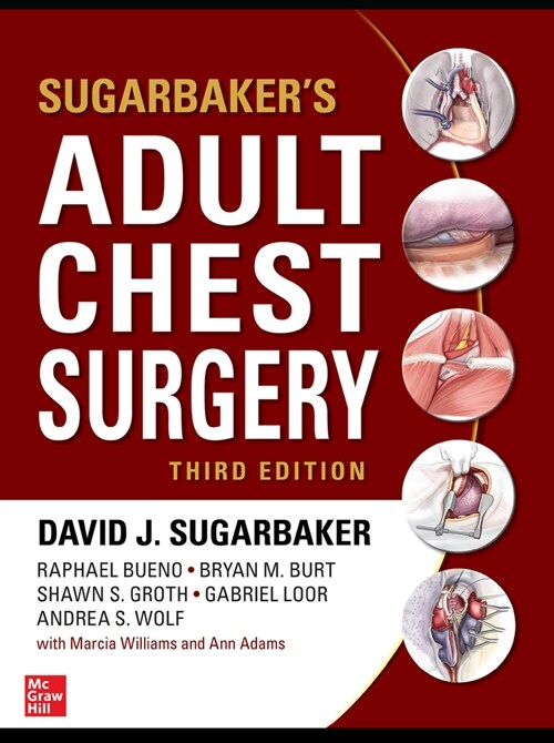 Sugarbakers Adult Chest Surgery, 3rd Edition (Hardcover, 3)