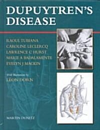 Dupuytrens Disease (Hardcover)
