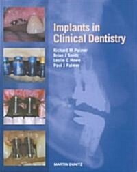 Implants in Clinical Dentistry (Hardcover)
